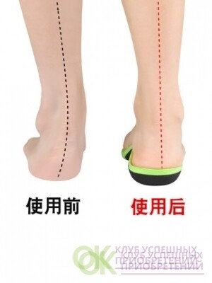 Ортопедические детские стельки Корректирующие X-образные ножки/ вальгус / плоскостопие
